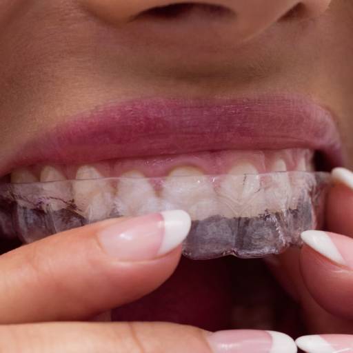ortodoncia cosmética dentista en málaga